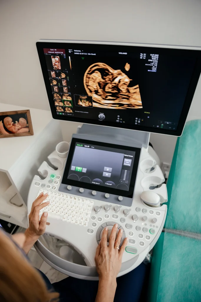 Kobieta korzysta z komputera, aby oglądać obraz ultrasonograficzny.