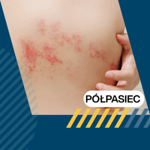Program w zakresie szczepień przeciwko półpaścowi i neuralgii półpaścowej